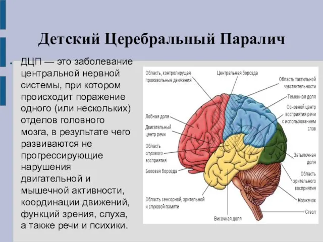 Детский Церебральный Паралич ДЦП — это заболевание центральной нервной системы,