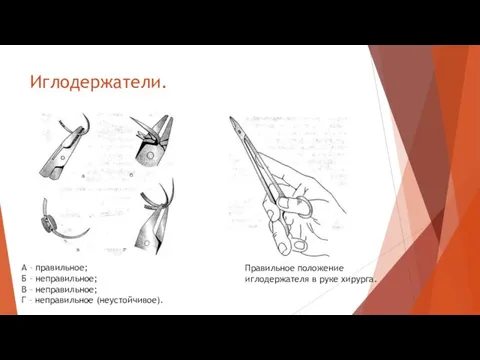 Иглодержатели. А – правильное; Б – неправильное; В – неправильное;