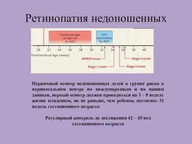 Ретинопатия недоношенных Первичный осмотр недоношенных детей в группе риска в