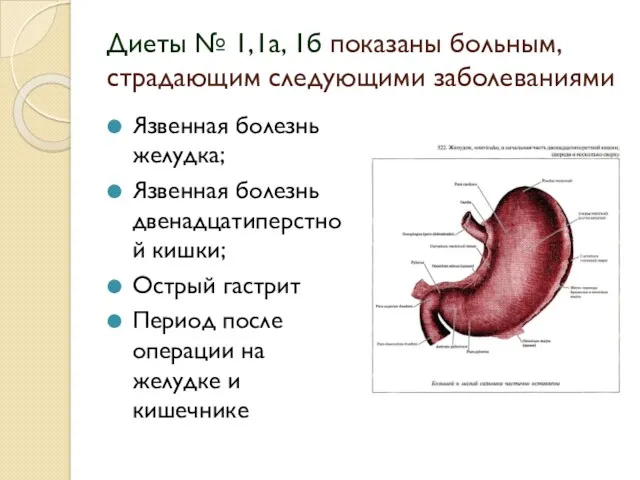 Диеты № 1,1а, 1б показаны больным, страдающим следующими заболеваниями Язвенная