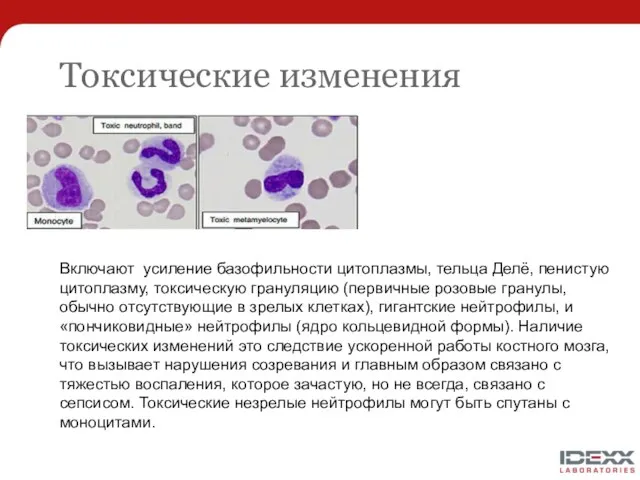 Токсические изменения Включают усиление базофильности цитоплазмы, тельца Делё, пенистую цитоплазму,