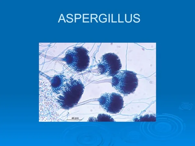 ASPERGILLUS