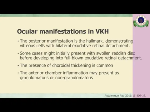 Ocular manifestations in VKH The posterior manifestation is the hallmark,