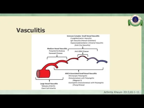 Vasculitis Arthritis Rheum 2013;65:1-11.