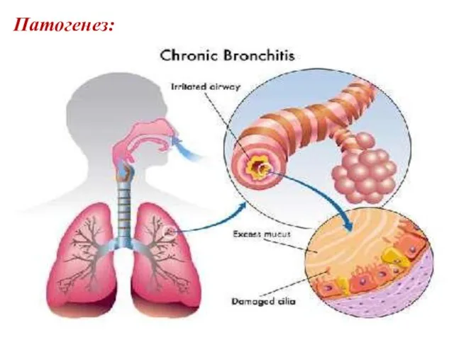 Патогенез: