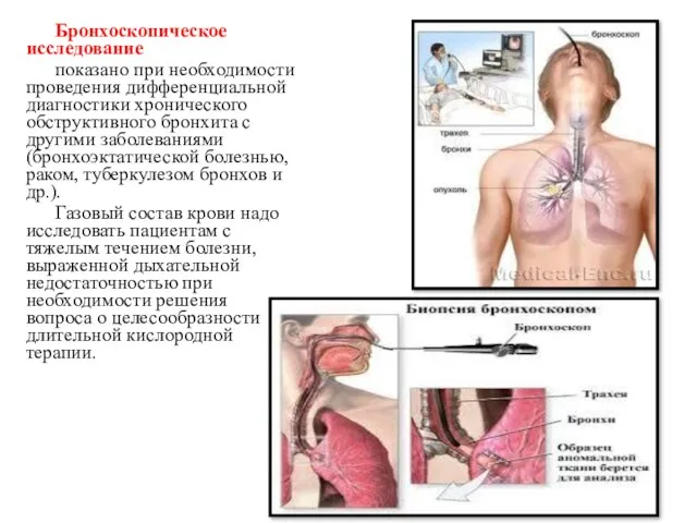 Бронхоскопическое исследование показано при необходимости проведения дифференциальной диагностики хронического обструктивного