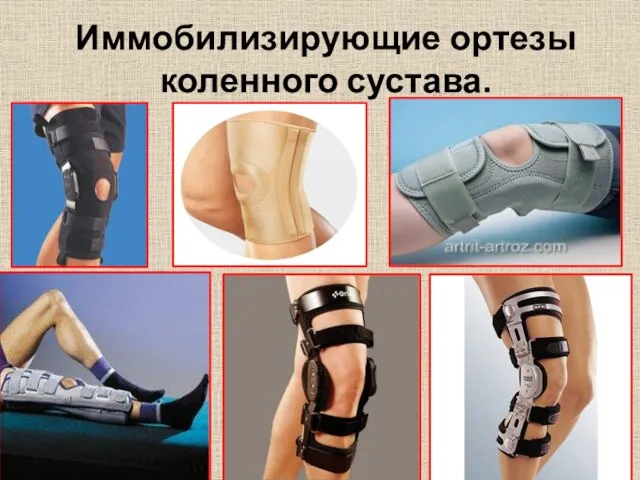 Иммобилизирующие ортезы коленного сустава.