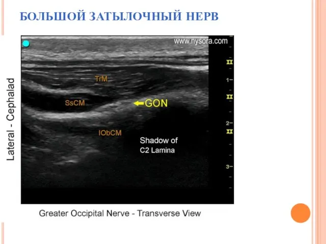 БОЛЬШОЙ ЗАТЫЛОЧНЫЙ НЕРВ