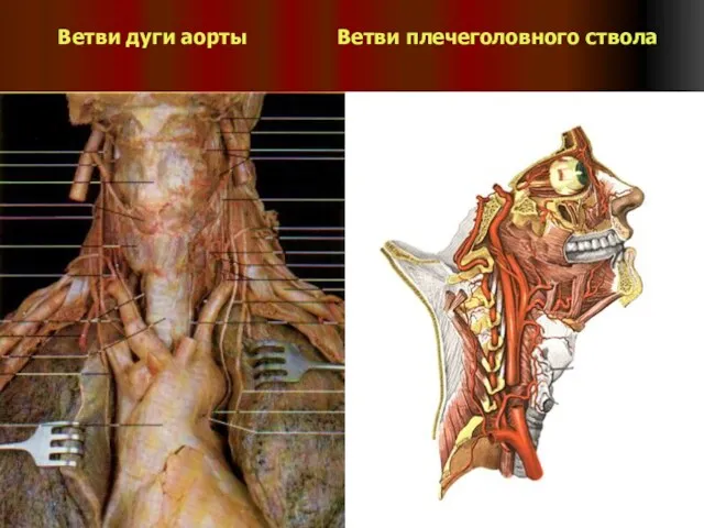 Ветви дуги аорты Ветви плечеголовного ствола