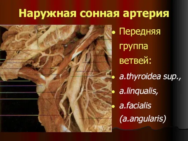 Наружная сонная артерия Передняя группа ветвей: a.thyroidea sup., a.linqualis, a.facialis (a.angularis)