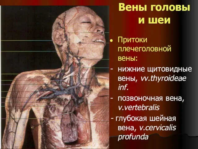 Вены головы и шеи Притоки плечеголовной вены: - нижние щитовидные вены, vv.thyroideae inf.