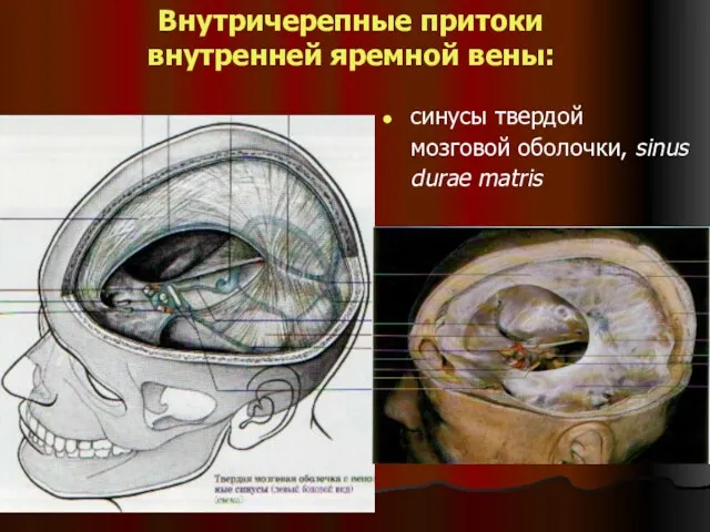 Внутричерепные притоки внутренней яремной вены: cинусы твердой мозговой оболочки, sinus durae matris