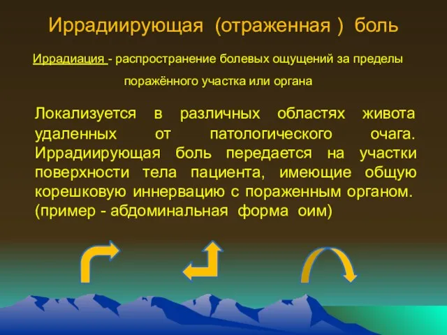 Иррадиирующая (отраженная ) боль Иррадиация - распространение болевых ощущений за