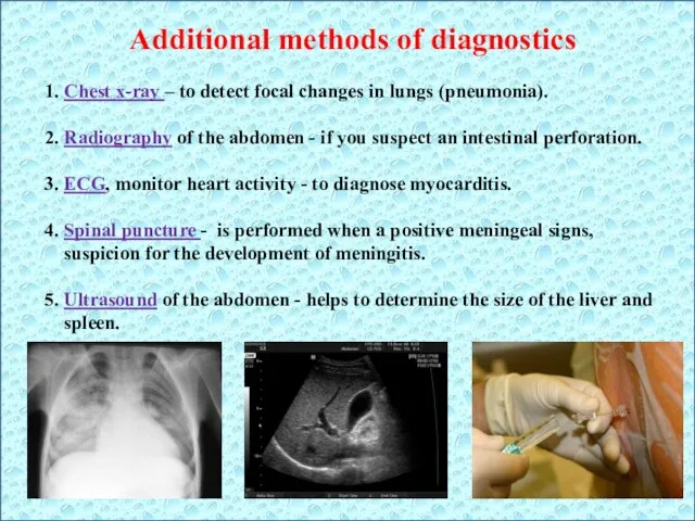 Additional methods of diagnostics 1. Chest x-ray – to detect