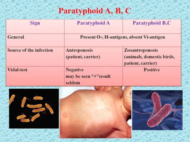 Paratyphoid A, B, C