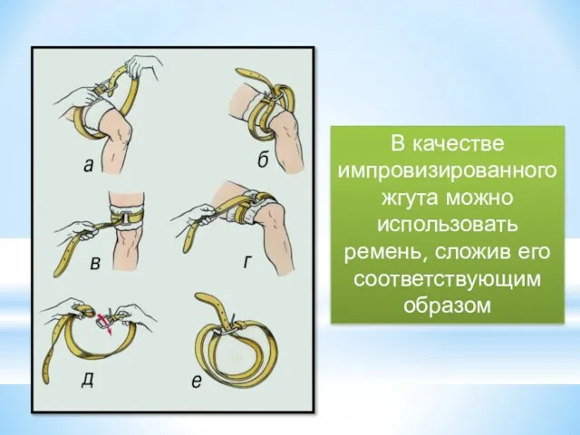 В качестве импровизированного жгута можно использовать ремень, сложив его соответствующим образом