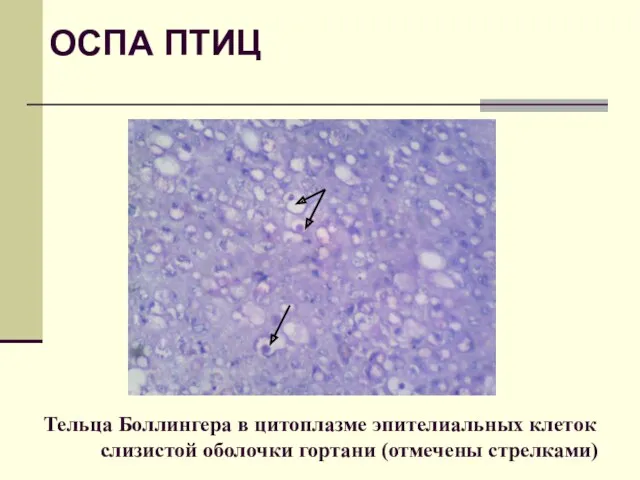 Тельца Боллингера в цитоплазме эпителиальных клеток слизистой оболочки гортани (отмечены стрелками) ОСПА ПТИЦ