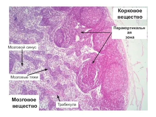 Корковое вещество Мозговое вещество Паракортикальная зона Мозговой синус Мозговые тяжи Трабекула