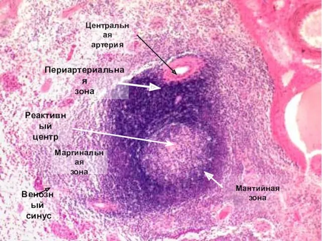 Центральная артерия Реактивный центр Маргинальная зона Мантийная зона Периартериальная зона Венозный синус