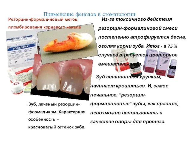 Зуб, леченый резорцин-формалином. Характерная особенность – красноватый оттенок зуба. Зуб