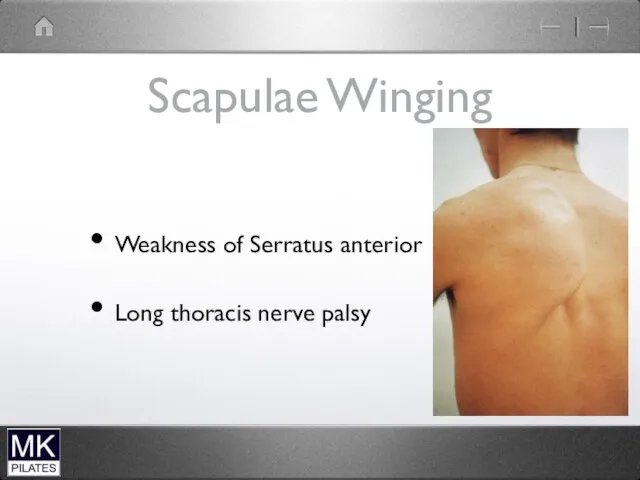 Scapulae Winging Weakness of Serratus anterior Long thoracis nerve palsy