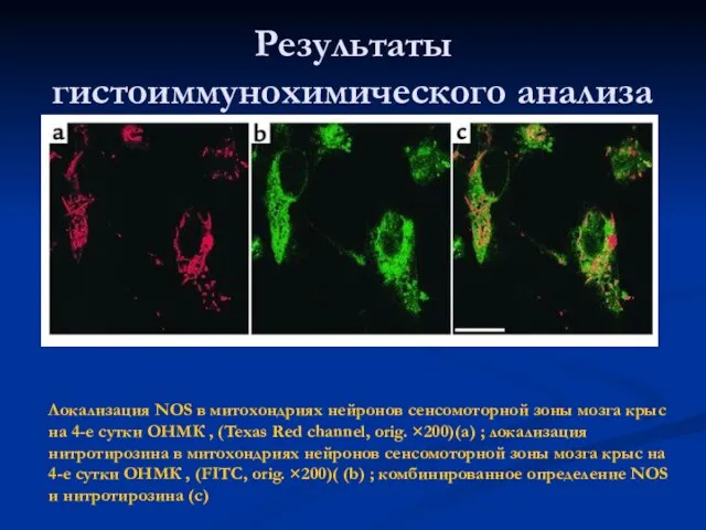 Результаты гистоиммунохимического анализа Локализация NOS в митохондриях нейронов сенсомоторной зоны