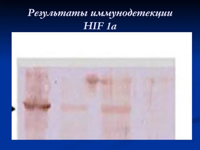 Результаты иммунодетекции HIF 1а