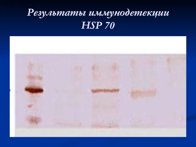 Результаты иммунодетекции HSP 70