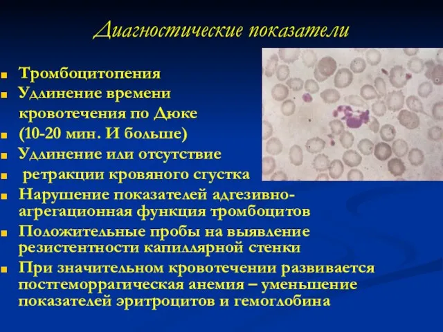 Диагностические показатели Тромбоцитопения Удлинение времени кровотечения по Дюке (10-20 мин.