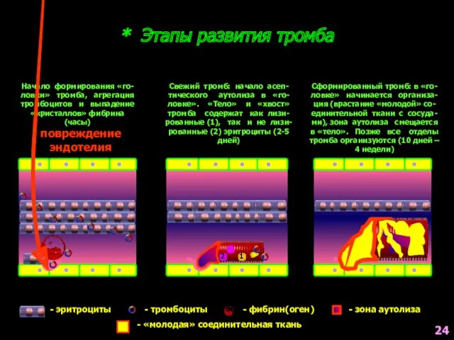 * Этапы развития тромба - эритроциты - тромбоциты - фибрин(оген)