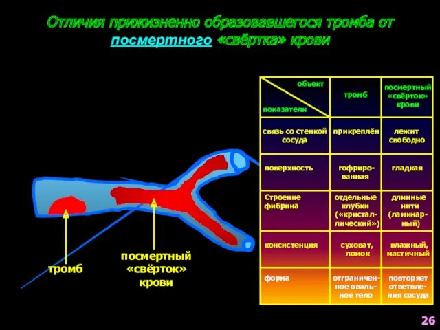 Отличия прижизненно образовавшегося тромба от посмертного «свёртка» крови тромб посмертный