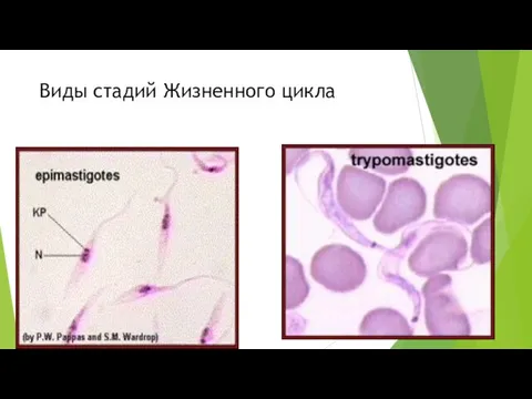 Виды стадий Жизненного цикла