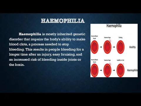 HAEMOPHILIA Haemophilia is mostly inherited genetic disorder that impairs the