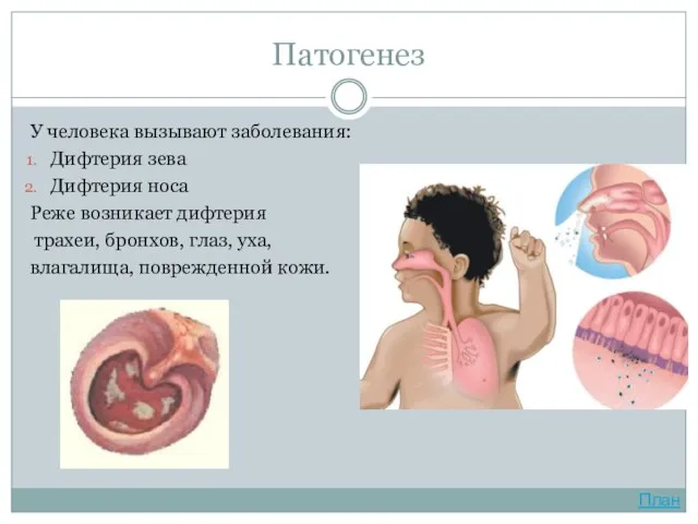 Патогенез У человека вызывают заболевания: Дифтерия зева Дифтерия носа Реже