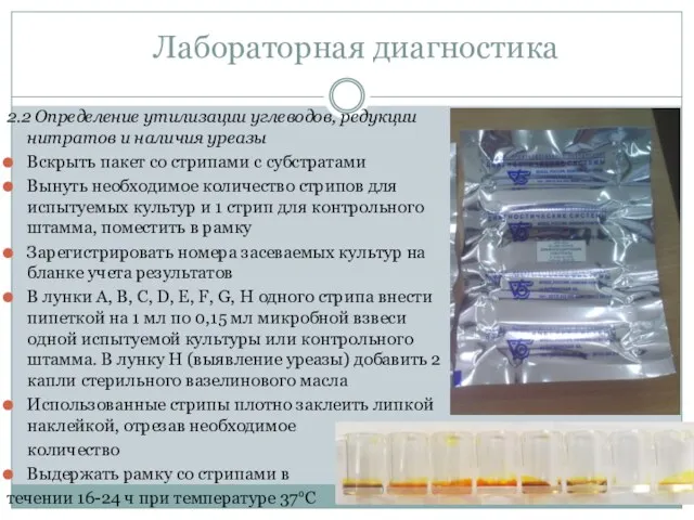 2.2 Определение утилизации углеводов, редукции нитратов и наличия уреазы Вскрыть