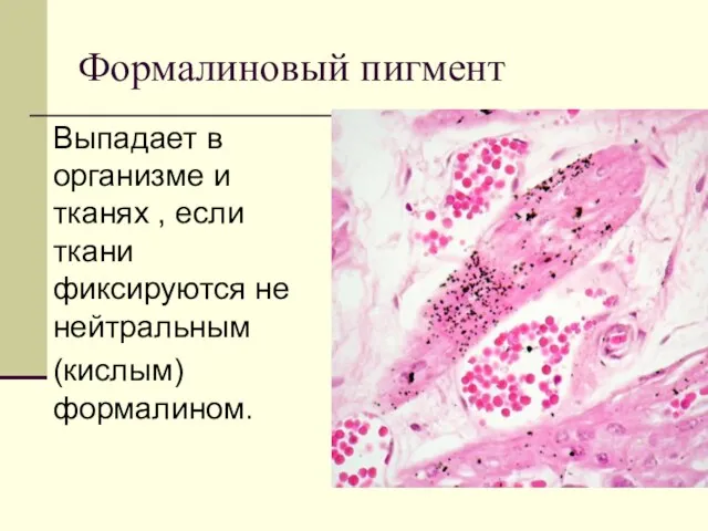 Формалиновый пигмент Выпадает в организме и тканях , если ткани фиксируются не нейтральным (кислым) формалином.