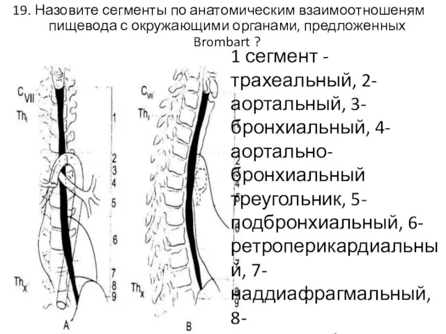 19. Назовите сегменты по анатомическим взаимоотношеням пищевода с окружающими органами,