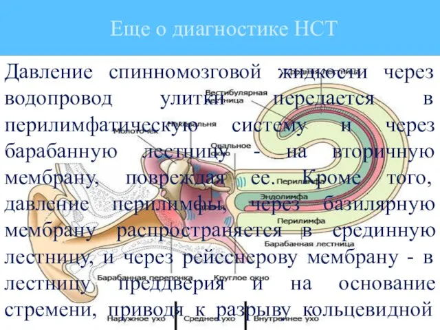 Еще о диагностике НСТ Давление спинномозговой жидкости через водопровод улитки