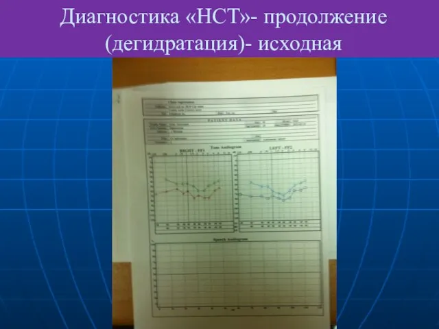 Диагностика «НСТ»- продолжение (дегидратация)- исходная