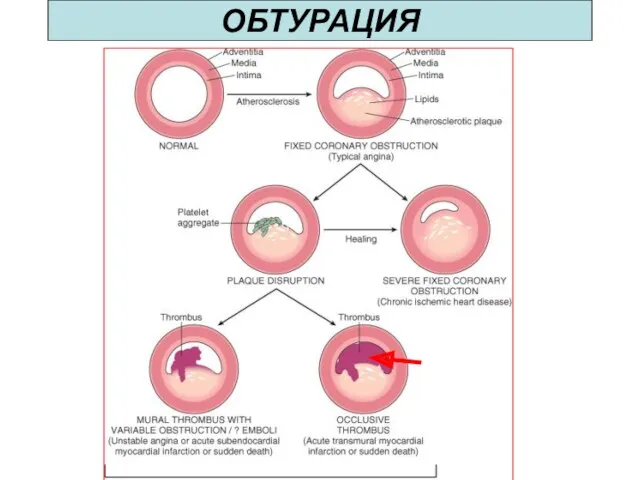 ОБТУРАЦИЯ