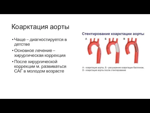 Чаще – диагностируется в детстве Основное лечение – хирургическая коррекция