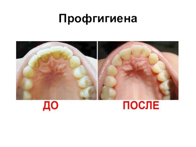 Профгигиена