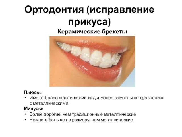Ортодонтия (исправление прикуса) Керамические брекеты Плюсы: Имеют более эстетический вид и менее заметны