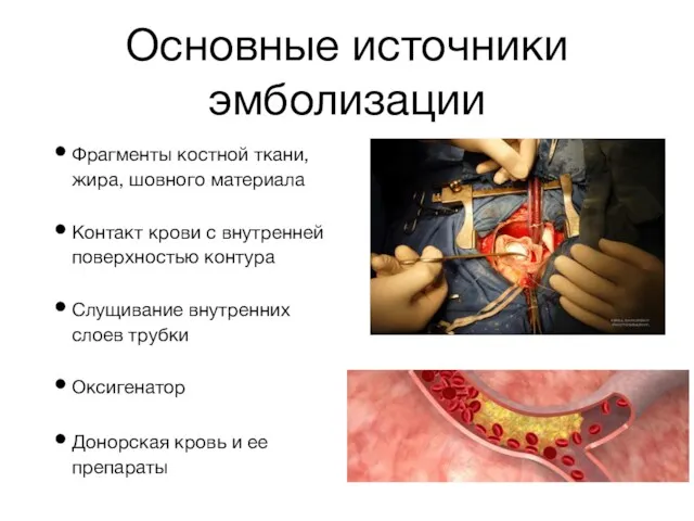 Основные источники эмболизации Фрагменты костной ткани, жира, шовного материала Контакт