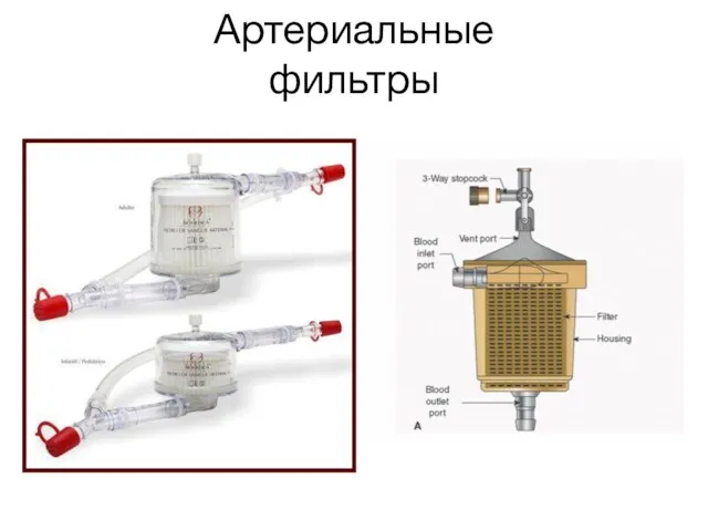 Артериальные фильтры