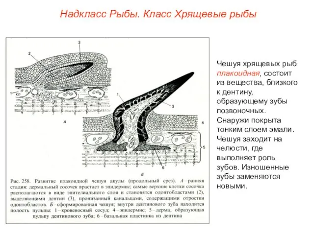 Надкласс Рыбы. Класс Хрящевые рыбы Чешуя хрящевых рыб плакоидная, состоит