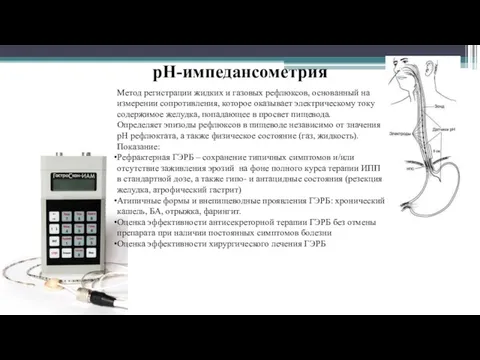 рН-импедансометрия Метод регистрации жидких и газовых рефлюксов, основанный на измерении