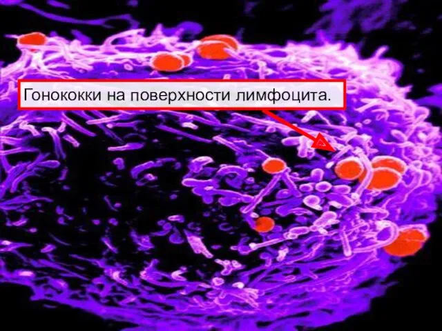 Гонококки на поверхности лимфоцита.