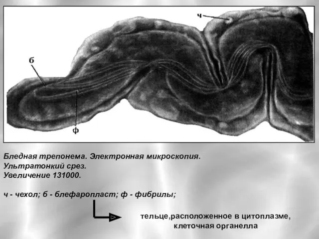 Бледная трепонема. Электронная микроскопия. Ультратонкий срез. Увеличение 131000. ч -