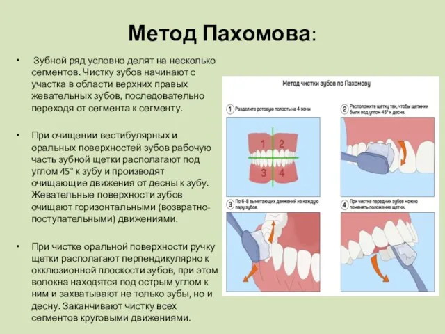 Метод Пахомова: Зубной ряд условно делят на несколько сегментов. Чистку